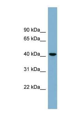 Western Blot: beta-1,4-Galactosyltransferase 2/B4GalT2 Antibody [NBP1-59863] - OVCAR-3 cell lysate, concentration 0.2-1 ug/ml.