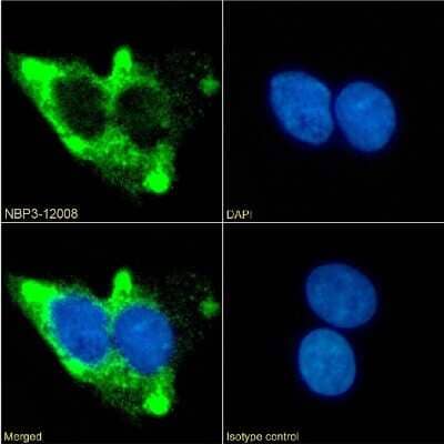 Immunocytochemistry/Immunofluorescence: beta-2 Adrenergic R/ADRB2 Antibody (13D6) - Chimeric [NBP3-12008] - Immunofluorescence analysis of paraformaldehyde fixed HepG2 cells on Shi-fix(TM) coverslips stained with the chimeric rabbit IgG version of 13D6 (NBP3-12008) at 10 ug/ml for 1h followed by Alexa Fluor(R) 488 secondary antibody (2 ug/ml), showing membrane staining. The nuclear stain is DAPI (blue). Panels show from left-right, top-bottom NBP3-12008, DAPI, merged channels and an isotype control. The isotype control was an unknown specificity antibody followed by staining with Alexa Fluor(R) 488 secondary antibody.