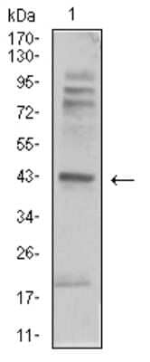 Western Blot: beta-2 Adrenergic R/ADRB2 Antibody (5G3B5) [NBP2-61710] - Analysis using ADRB2 mouse mAb against C6 (1) cell lysate.