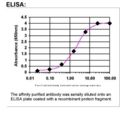 ELISA: beta-2 Adrenergic R/ADRB2 Antibody [19560002]