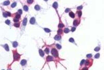 Immunocytochemistry: beta-2 Adrenergic R/ADRB2 Antibody [NLS2656] -  Staining of HEK293 human embryonic kidney cells transfected with ADRB2.