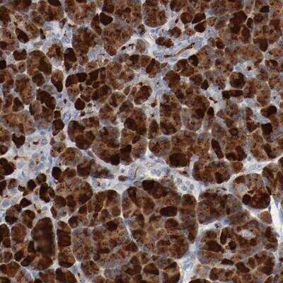 Immunohistochemistry-Paraffin: beta-2 Adrenergic R/ADRB2 Antibody [NBP1-90227] - Staining of human pancreas shows strong cytoplasmic positivity in exocrine glandular cells.