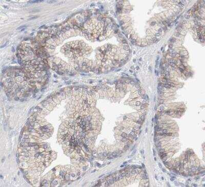 Immunohistochemistry-Paraffin: beta-2 Adrenergic R/ADRB2 Antibody [NBP1-90227] - Staining of human prostate shows moderate membranous positivity in glandular cells.