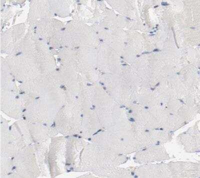 Immunohistochemistry-Paraffin: beta-2 Adrenergic R/ADRB2 Antibody [NBP1-90227] - Staining of human skeletal muscle shows very weak membranous positivity in myocytes. 