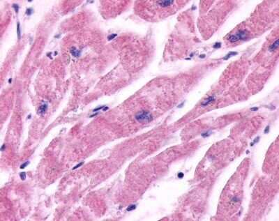 Immunohistochemistry-Paraffin: beta-2 Adrenergic R/ADRB2 Antibody [NLS2656] - Analysis of anti-ADRB2 antibody with heart, cardiac myocytes at 5 ug/ ml.