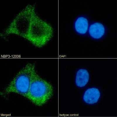 Immunocytochemistry/Immunofluorescence: beta-2 Adrenergic R/ADRB2 Antibody (R11/E1) - Chimeric [NBP3-12006] - Immunofluorescence analysis of paraformaldehyde fixed A431 cells on Shi-fix(TM) coverslips stained with the chimeric rabbit IgG version of R11/E1 (NBP3-12006) at 10 ug/ml for 1h followed by Alexa Fluor(R) 488 secondary antibody (2 ug/ml), showing membrane staining. The nuclear stain is DAPI (blue). Panels show from left-right, top-bottom NBP3-12006, DAPI, merged channels and an isotype control. The isotype control was an unknown specificity antibody followed by staining with Alexa Fluor(R) 488 secondary antibody.