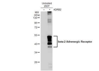 Western Blot: beta-2 Adrenergic R/ADRB2 Antibody [NBP2-15564] - Non-transfected (-) and transfected (+) unboiled 293T whole cell extracts (30 ug) were separated by 10% SDS-PAGE, and the membrane was blotted with beta 2 Adrenergic Receptor antibody [C2C3], C-term diluted at 1:5000. The HRP-conjugated anti-rabbit IgG antibody (NBP2-19301) was used to detect the primary antibody.