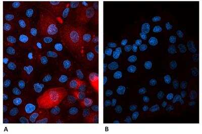 Immunocytochemistry/Immunofluorescence: beta 2-Microglobulin Antibody (B2M-01) [Biotin] [NBP1-44521] -  Human beta-2-microglobulin-transfected canine cells labeled A) with B2M-01 antibody Alexa Fluor (R)  647 conjugate  and B) with Alexa Fluor (R) 647 conjugated Mouse IgG2a Isotype Control . Cells were fixed with 4% PFA and permeabilized with 0.1% PBS-Tween20 containing 2% BSA. Antibody concentration 2ug/ml.  