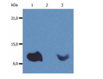 Western Blot: beta 2-Microglobulin Antibody (B2M-01) [Biotin] [NBP1-44521] - Analysis (non-reducing conditions) of whole cell lysate of various cell lines using anti-human beta-t2-microglobulin (B2M-01). Lane 1: RAJI human Burkitt lymphoma cell line Lane 2: EL4 mouse lymphoblastic lymphoma cell line Lane 3: U937 human histiocytic lymphoma cell line