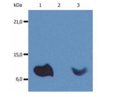 Western Blot: beta 2-Microglobulin Antibody (B2M-01) [HRP] [NBP1-44520] -  Analysis (non-reducing conditions) of whole cell lysate of various cell lines using anti-human beta2-microglobulin (B2M-01). Lane 1: RAJI human Burkitt lymphoma cell line Lane 2: EL4 mouse lymphoblastic lymphoma cell line Lane 3: U937 human histiocytic lymphoma cell line