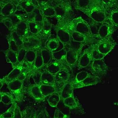 Immunocytochemistry/Immunofluorescence: beta 2-Microglobulin Antibody (B2M/1118) - Azide and BSA Free [NBP2-47702] - Immunofluorescent staining of HeLa cells. beta 2-Microglobulin Mouse Monoclonal Antibody (B2M/1118) followed by goat anti-Mouse IgG-CF488 (Green).