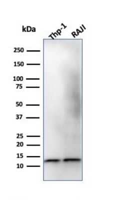 Western Blot: beta 2-Microglobulin Antibody (B2M/1118) - Azide and BSA Free [NBP2-47702] - Western Blot Analysis of THP-1 and Raji Cell lysate using beta 2-Microglobulin Antibody (B2M/1118).