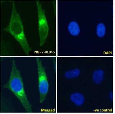 Immunocytochemistry/Immunofluorescence: beta 2-Microglobulin Antibody (BBM.1) - Chimeric [NBP2-81045] - Immunofluoresence staining of fixed HeLa cells with anti-Beta-2 microglobulin antibody BBM.1 [NBP2-81045]. Immunofluorescence analysis of paraformaldehyde fixed HeLa cells, permeabilized with 0.15% Triton stained with the chimeric rabbit IgG version of BBM.1 [NBP2-81045] at 10 ug/ml for 1h followed by Alexa Fluor 488 secondary antibody (1 ug/ml), showing endoplasmic reticulum staining. The nuclear stain is DAPI (blue). Panels show from left-right, top-bottom NBP2-81045, DAPI, merged channels and a negative control. The negative control was stained with unimmunized rabbit IgG followed by Alexa Fluor 488 secondary antibody.