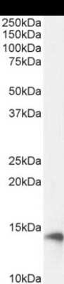 Western Blot: beta 2-Microglobulin Antibody (BBM.1) - Chimeric [NBP2-81045] - Western Blot using anti-Beta-2 microglobulin antibody BBM.1 [NBP2-81045]. HeLa cell lysate (35ug protein in RIPA buffer) was resolved on a 10% SDS PAGE gel and blots probed with the chimeric rabbit version of BBM.1 [NBP2-81045] at 0.03 ug/ml before detection using an anti-rabbit secondary antibody. A primary incubation of 1h was used and protein was detected by chemiluminescence. The expected band size for Beta-2 microglobulin is 13.7 kDa. NBP2-81045 successfully detected human Beta-2 microglobulin in both HeLa cell extract and human duodenum samples.