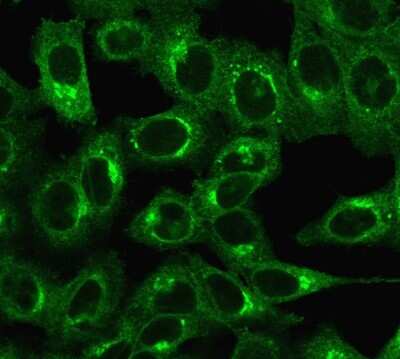 Immunocytochemistry/Immunofluorescence: beta 2-Microglobulin Antibody (C21.48A1) - Azide and BSA Free [NBP3-11404] - Immunofluorescent staining of HeLa cells. beta 2-Microglobulin Mouse Monoclonal Antibody (C21.48A1) followed by goat anti-Mouse IgG-CF488 (Green).