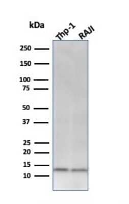 Western Blot: beta 2-Microglobulin Antibody (C21.48A1) [NBP2-44470] - Western Blot Analysis of THP-1 and Raji cell lysate using beta 2-Microglobulin Antibody (C21.48A1).