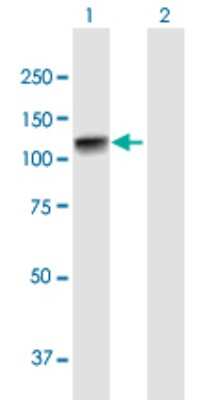 Western Blot: beta Adducin Antibody [H00000119-B01P] - Analysis of ADD2 expression in transfected 293T cell line by ADD2 polyclonal antibody.  Lane 1: ADD2 transfected lysate(79.86 KDa). Lane 2: Non-transfected lysate.