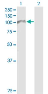 Western Blot: beta Adducin Antibody [H00000119-D01P] - Analysis of ADD2 expression in transfected 293T cell line by ADD2 polyclonal antibody.Lane 1: ADD2 transfected lysate(80.80 KDa).Lane 2: Non-transfected lysate.