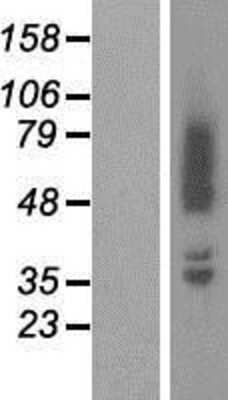 Western Blot: beta Adducin Overexpression Lysate (Adult Normal) [NBP2-06977] Left-Empty vector transfected control cell lysate (HEK293 cell lysate); Right -Over-expression Lysate for beta Adducin.