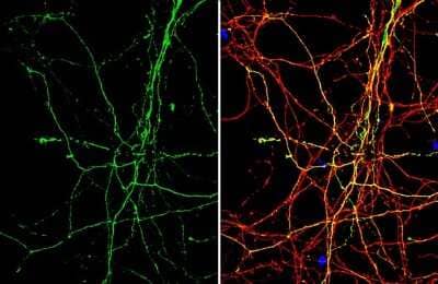 Immunocytochemistry/Immunofluorescence: beta-Alanine Antibody [NBP3-13408] - beta-Alanine antibody detects beta-Alanine protein by immunofluorescent analysis. Sample: DIV9 rat E18 primary hippocampal neuron cells were fixed in 4% paraformaldehyde at RT for 15 min. Green: beta-Alanine stained by beta-Alanine antibody (NBP3-13408) diluted at 1:500. Red: Tau, stained by Tau antibody [GT287] diluted at 1:500. Blue: Fluoroshield with DAPI.