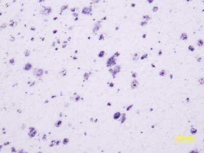 Immunohistochemistry-Paraffin: beta Amyloid 42 Antibody [NBP2-44113] - Detection of beta Amyloid deposits in a case of Alzheimer's disease. Image from a verified customer review.