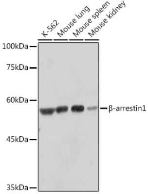 Western Blot: beta-Arrestin 1 Antibody (F7C2) [NBP3-15335] - Western blot analysis of extracts of various cell lines, using beta-Arrestin 1 Rabbit mAb (NBP3-15335) at 1:1000 dilution. Secondary antibody: HRP Goat Anti-Rabbit IgG (H+L) at 1:10000 dilution. Lysates/proteins: 25ug per lane. Blocking buffer: 3% nonfat dry milk in TBST. Detection: ECL Basic Kit. Exposure time: 3s.