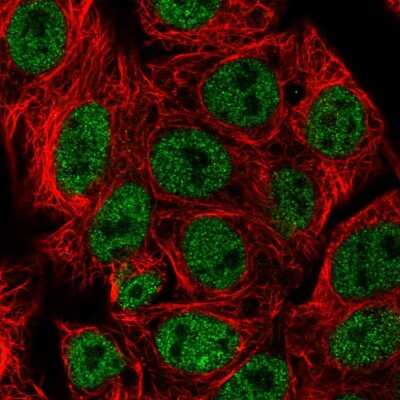 Immunocytochemistry/Immunofluorescence: beta-Arrestin 1 Antibody [NBP2-58092] - Staining of human cell line Hep G2 shows localization to nucleoplasm.