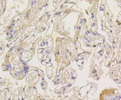 Immunohistochemistry-Paraffin: beta-Arrestin 1 Antibody (ST51-08) [NBP2-67510] - Analysis of paraffin-embedded human lung tissue using anti-beta Arrestin 1 antibody. Counter stained with hematoxylin.