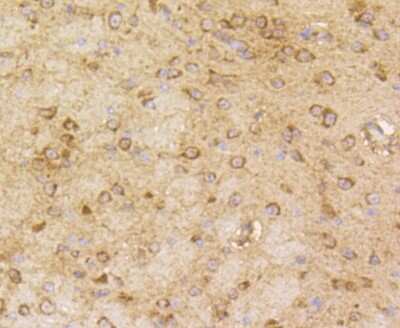 Immunohistochemistry-Paraffin: beta-Arrestin 1 Antibody (ST51-08) [NBP2-67510] - Analysis of paraffin-embedded mouse brain tissue using anti-beta Arrestin 1 antibody. Counter stained with hematoxylin.