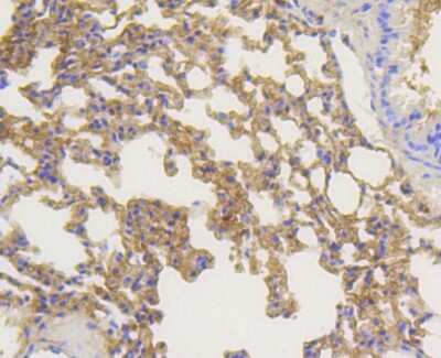 Immunohistochemistry-Paraffin: beta-Arrestin 1 Antibody (ST51-08) [NBP2-67510] - Analysis of paraffin-embedded mouse lung tissue using anti-beta Arrestin 1 antibody. Counter stained with hematoxylin.