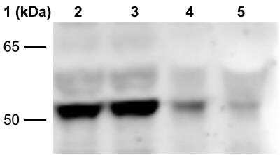 Western Blot: beta-Arrestin 1 Antibody (ST51-08) [NBP2-67510] - Analysis of MIN6 and mouse pancreatic islets. Lane 1: Molecular Weight Ladder. Lanes 2-3: MIN6 cells (~10 ug). Lane 4: pooled wild-type pancreatic islets (~5 ug). Lane 5: pooled beta-arrestin 1 knockout pancreatic islets (~5 ug). Primary Antibody: Anti-beta-arrestin 1 Ab at 1:750 overnight at 4C. Secondary Antibody: Goat Anti-rabbit IgG: HRP at 1:3000 for 1hr RT. Image from verified customer review.