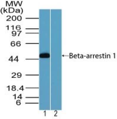 Western Blot: beta-Arrestin 1 Antibody [NBP2-24626] -  Analysis of Arrestin beta 1 in human testis lysate in the 1) absence and 2) presence of immunizing peptide using NBP2-24626 at 2.0 ug/ml. Goat anti-rabbit Ig HRP secondary antibody and PicoTect ECL substrate solution were used for this test.