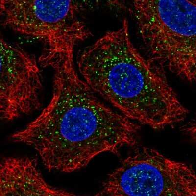 Immunocytochemistry/Immunofluorescence: beta-Arrestin 2 Antibody [NBP2-55904] - Staining of human cell line A549 shows localization to vesicles.