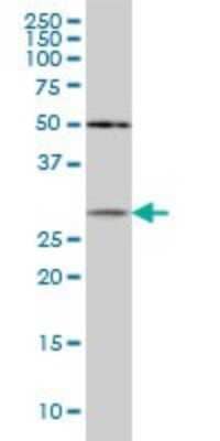 Western Blot: beta B1 Crystallin Antibody (3D9) [H00001414-M03] - Analysis of CRYBB1 expression in MCF-7 (Cat # L046V1).