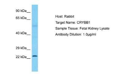 Western Blot: beta B1 Crystallin Antibody [NBP2-87073] - Host: Rabbit. Target Name: CRYBB1. Sample Tissue: Human Fetal Kidney. Antibody Dilution: 1ug/ml