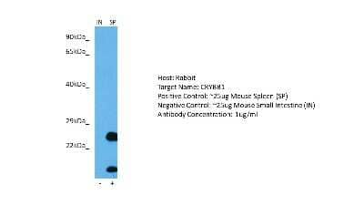 Western Blot: beta B1 Crystallin Antibody [NBP2-87073] - Host: Rabbit. Target: CRYBB1. Positive control (+): Mouse Spleen (M-SP). Negative control (-): Mouse Small Intestine (M-IN). Antibody concentration: 1ug/ml