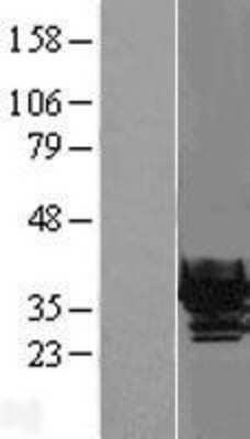 Western Blot: beta B1 Crystallin Overexpression Lysate (Adult Normal) [NBL1-09499] Left-Empty vector transfected control cell lysate (HEK293 cell lysate); Right -Over-expression Lysate for beta B1 Crystallin.