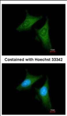 Immunocytochemistry/Immunofluorescence: beta COP Antibody [NBP2-15579] - Immunofluorescence analysis of methanol-fixed HeLa, using antibody at 1:200 dilution.