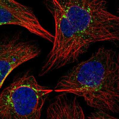 Immunocytochemistry/Immunofluorescence: beta COP Antibody [NBP2-38519] - Immunofluorescent staining of human cell line U-2 OS shows localization to vesicles.