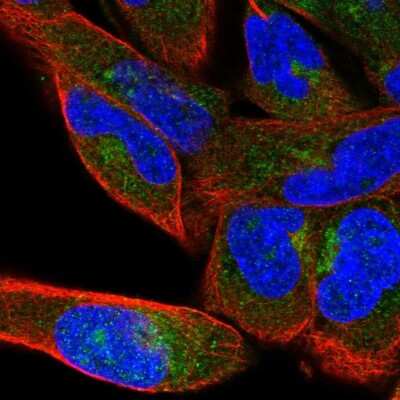 Immunocytochemistry/Immunofluorescence: beta COP Antibody [NBP2-39027] - Immunofluorescent staining of human cell line RH-30 shows localization to cytosol & the Golgi apparatus. Antibody staining is shown in green.