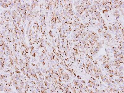 Immunohistochemistry-Paraffin: beta COP Antibody [NBP2-15579] - Immunohistochemical analysis of paraffin-embedded U87 xenograft, using antibody at 1:100 dilution.