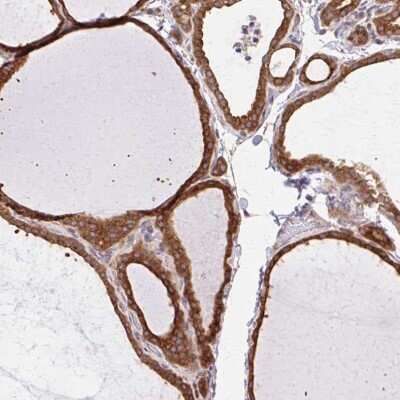 Immunohistochemistry-Paraffin: beta COP Antibody [NBP2-38519] - Staining of human thyroid gland shows strong cytoplasmic positivity in glandular cells.