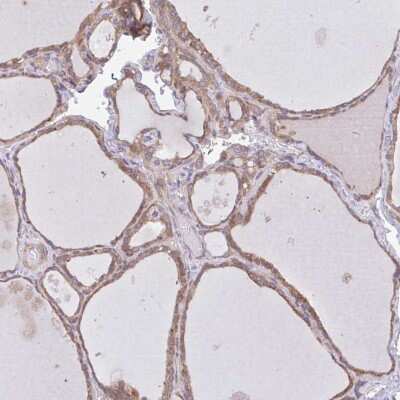 Immunohistochemistry-Paraffin: beta COP Antibody [NBP2-39027] - Staining of human thyroid gland shows moderate cytoplasmic positivity in glandular cells.