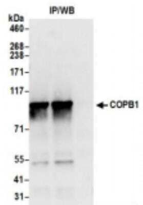 <b>Biological Strategies Validation. </b>Immunoprecipitation: beta COP Antibody [NBP2-41358] - Samples: Whole cell lysate (0.5 or 1.0 mg per IP reaction; 20% of IP loaded) from 293T cells prepared using NETN lysis buffer. Antibodies: Affinity purified rabbit anti-COPB1 antibody NBP2-41358 used for IP at 6 ug per reaction. COPB1 was also immunoprecipitated by rabbit anti-COPB1 antibody NBP2-41358. For blotting immunoprecipitated COPB1, it was used at 0.4 ug/ml. Detection: Chemiluminescence with an exposure time of 3 seconds.