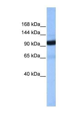 Western Blot: beta COP Antibody [NBP1-53091] - Human Liver cell lysate, concentration 0.2-1 ug/ml.