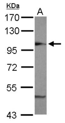 Western Blot: beta COP Antibody [NBP2-15577] - Sample (30 ug of whole cell lysate) A: MCF-7 7. 5% SDS PAGE gel, diluted at 1:5000.