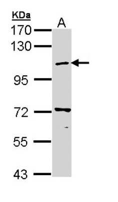 Western Blot: beta COP Antibody [NBP2-15579] - Sample (30 ug of whole cell lysate) A: Hep G2 7. 5% SDS PAGE gel, diluted at 1:1000.