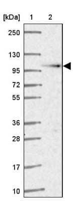 Western Blot: beta COP Antibody [NBP2-39027] - Lane 1: Marker  [kDa] 250, 130, 95, 72, 55, 36, 28, 17, 10.  Lane 2: Human cell line RT-4