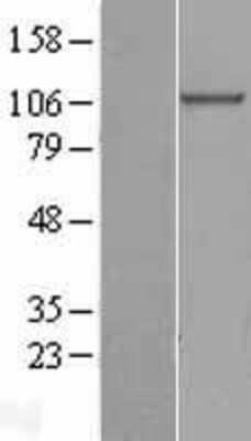 Western Blot: beta COP Overexpression Lysate (Adult Normal) [NBL1-09377] Left-Empty vector transfected control cell lysate (HEK293 cell lysate); Right -Over-expression Lysate for beta COP.