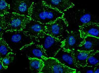 Immunocytochemistry/Immunofluorescence: beta-Catenin Antibody (021) [NBP2-89875] -  Staining of Human CTNNB1 in A431 cells. Cells were fixed with 4% PFA, permeabilzed with 0.3% Triton X-100 in PBS, blocked with 10% serum, and incubated with rabbit anti-Human CTNNB1 monoclonal antibody (1:60) at 4c overnight. Then cells were stained with the Alexa Fluor(R) 488-conjugated Goat Anti-rabbit IgG secondary antibody (green) and counterstained with DAPI (blue). Positive staining was localized to cells membrane.